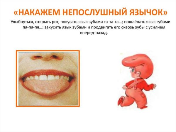 Логопедические упражнения Непослушный язычок