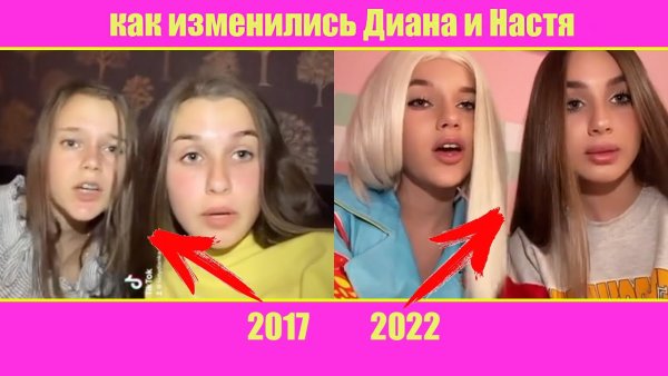 Кнопа из леди Диана одна