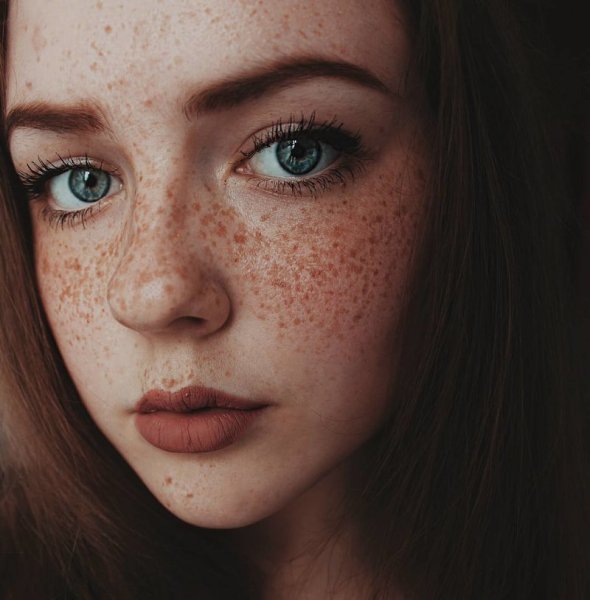 Селина Скиндер веснушки