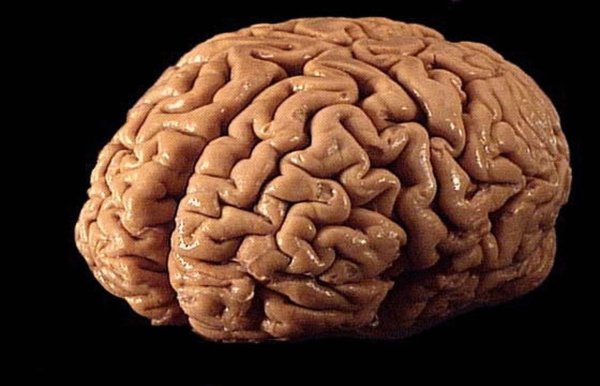 Картинки мозг человека (47 фото)