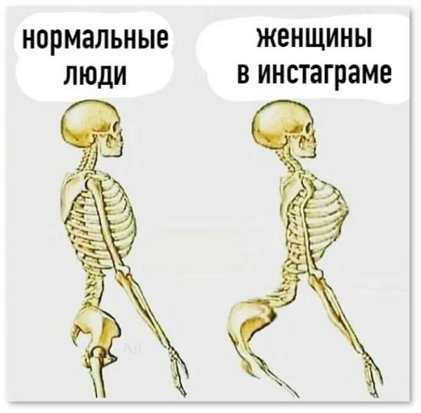 Нормальный скелет человека в профиль