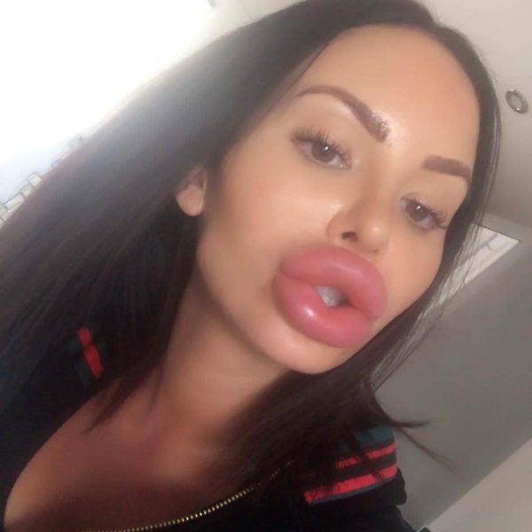 Юлианна Разуваева губищи